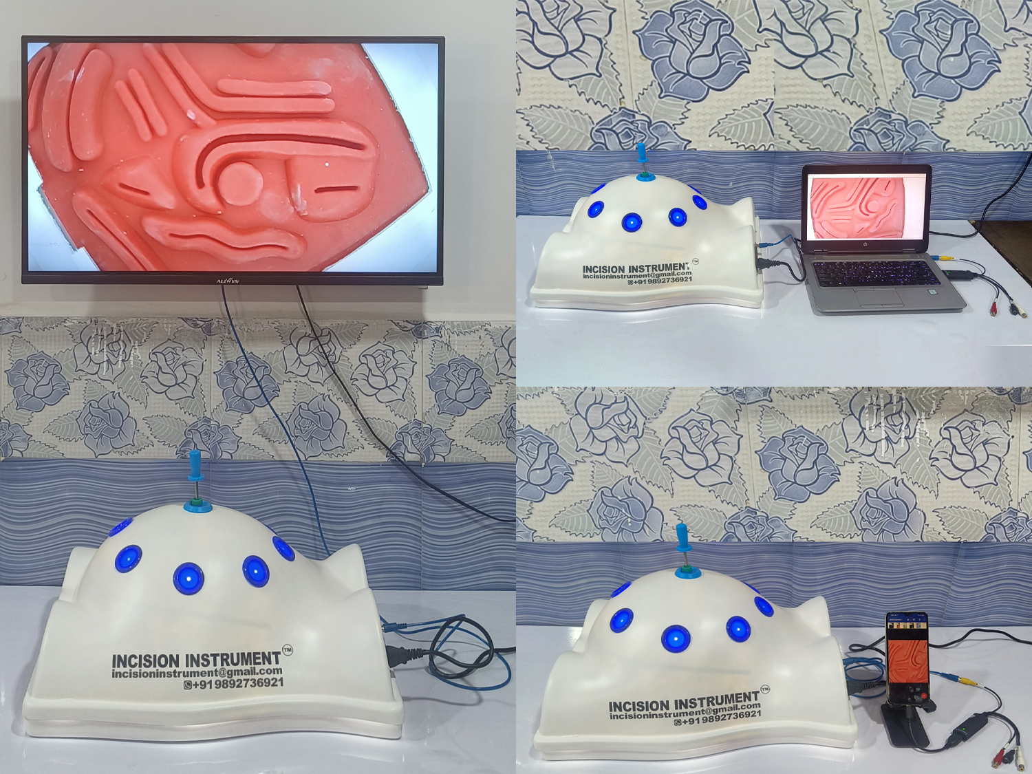 White Full body Shape Endo Trainer TV Laptop Mobile Connection